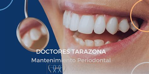 Mantenimiento Periodontal