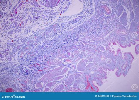 Columnar Epithelium Of Human Gall Bladder Under The Microscope In Lab