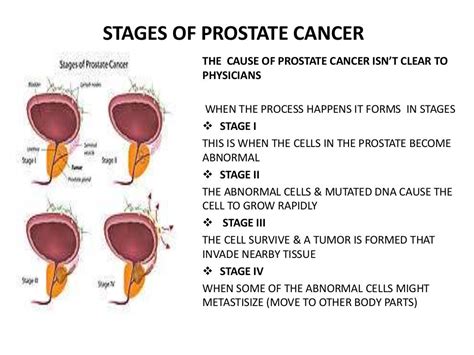 Prostate Cancer Cause Defined Symptom Risk Factors