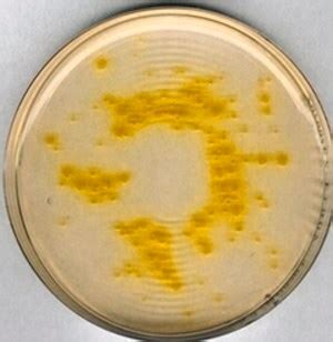 Burkholderia Cepacia Selective Agar Suitable For Microbiology