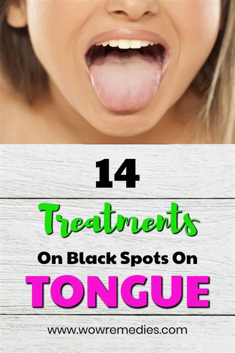 Black Spot On Tongue - Black Tongue Causes Treatments And Home Remedies ...