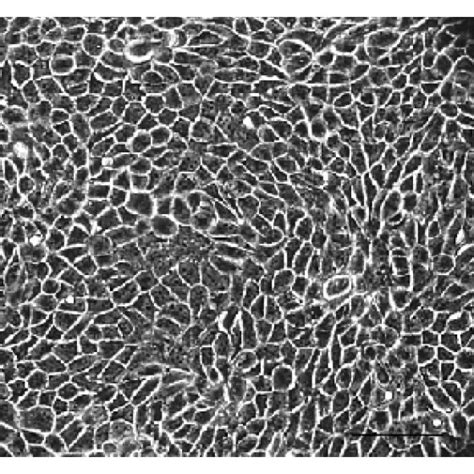 Light And Confocal Microscopy Of Acanthamoeba Griffini Trophozoites Download Scientific