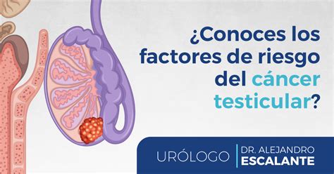 Importancia De La Prevención Del Cáncer Testicular Dr Alejandro