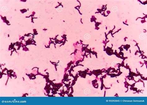 Gram Stain Test Showing Bacteria Cells. Royalty-Free Stock Photo ...