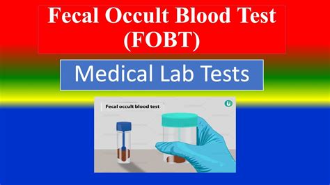 Fecal Occult Blood Test FOBT Medical Lab Tests What Is Uses