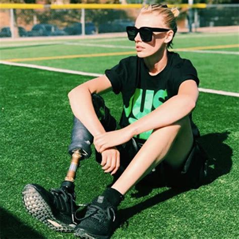 Model Who Lost Leg To Toxic Shock Syndrome Caused By Tampon Reveals She