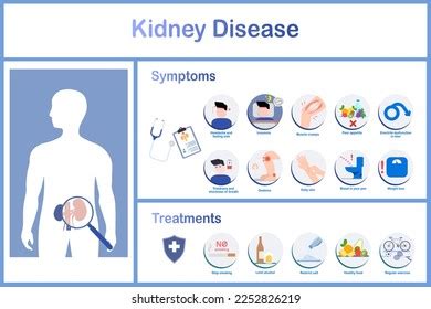 Infographics Various Symptoms Kidney Disease Treatments Stock Vector ...