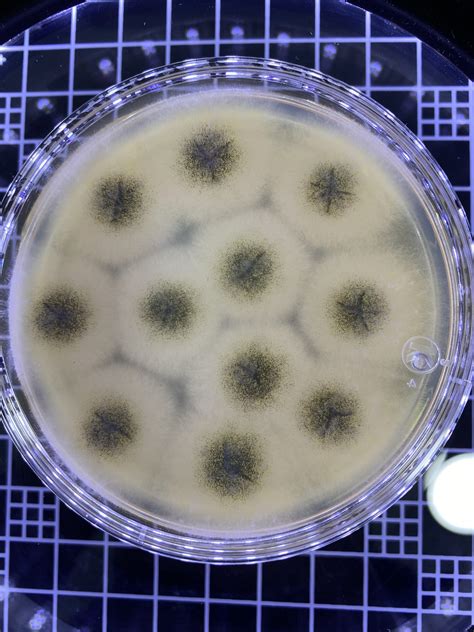 Hongos Y Levaduras An Lisis Microbiol Gicos