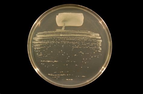 Rhizobium - Beneficial Microbe