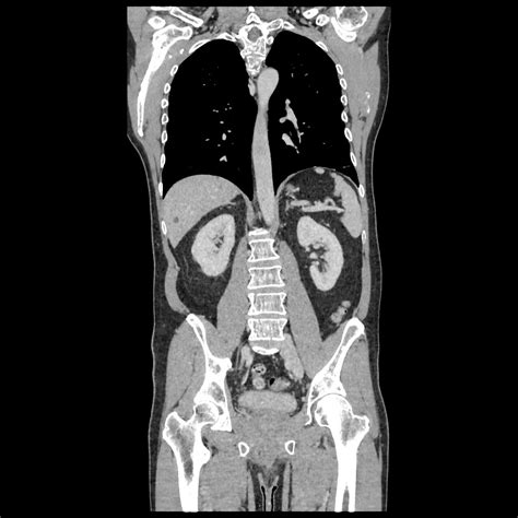 Scanner Tap Hopital Claude Galien