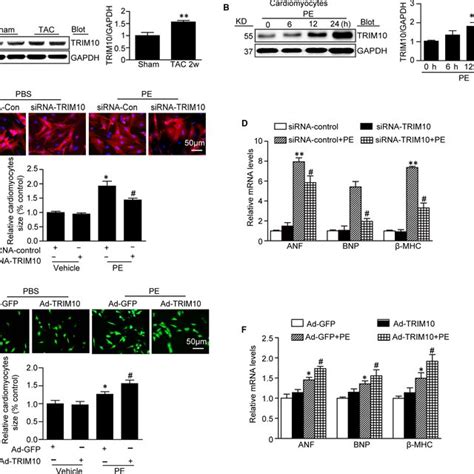 Trim Knockdown Attenuates Peinduced Cardiomyocyte Hypertrophy In