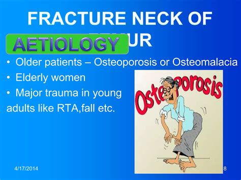 Fracture Of The Neck Of Femur 3