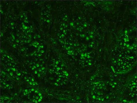 抗神经丝200抗体小鼠单克隆Anti Neurofilament 200 antibody Mouse monoclonal