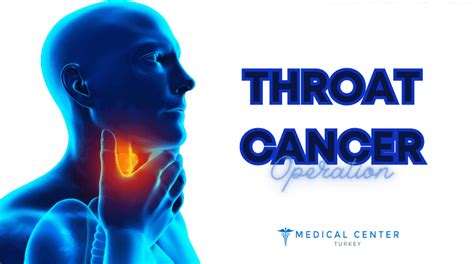 throat cancer operation mct