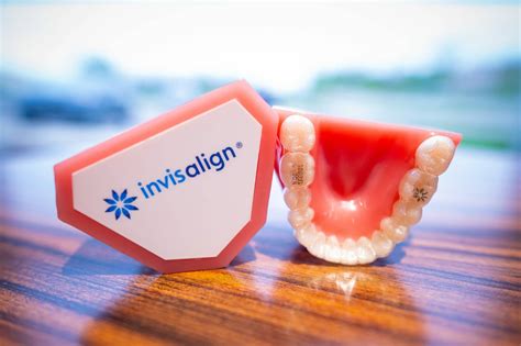 Before And After Invisalign • Grand Rapids Mi