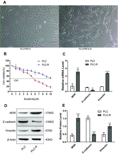 The Sorafenib Resistant Hepatocellular Carcinoma Cell Line PLC PRF 5 R