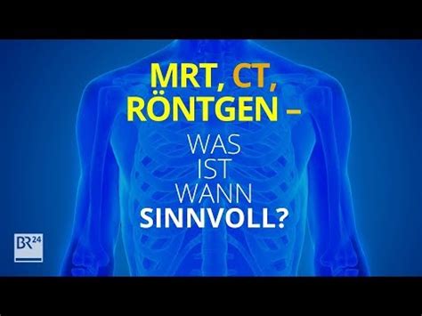 MRT CT Röntgen Was ist wann sinnvoll und wie steht es um