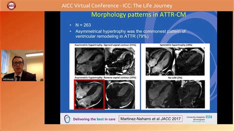 Dr William Moody Dr William Moody Consultant Cardiologist In Imaging