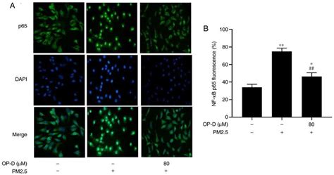 Immunofluorescence staining of NF κBp65 in MLE 12 cells MLE 12 cells