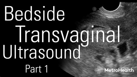 Transvaginal Ultrasound During Pregnancy, 41% OFF