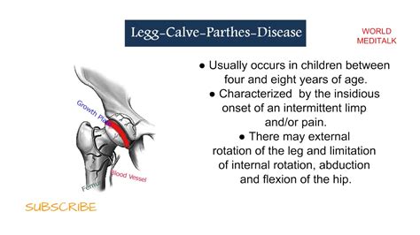 Stages Of Legg Calve Perthes Disease