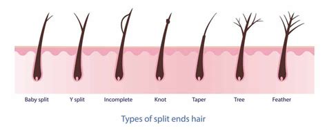 Split Ends Everything You Need To Know