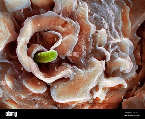 Shigella Bacterium Coloured Scanning Electron Micrograph Sem Of A