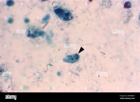 This Photomicrograph Revealed A Good Example Of A Trichrome Stained Binucleate Dientamoeba