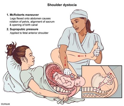 Nursing School Studying Nursing School Notes Nursing Study Ob