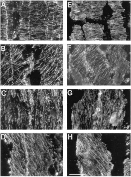 Micrographs Of Cortical Microtubules In Medianlongitudinal Sections