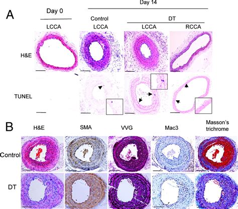 Smooth Muscle Cell Apoptosis Promotes Vessel Remodeling And Repair Via