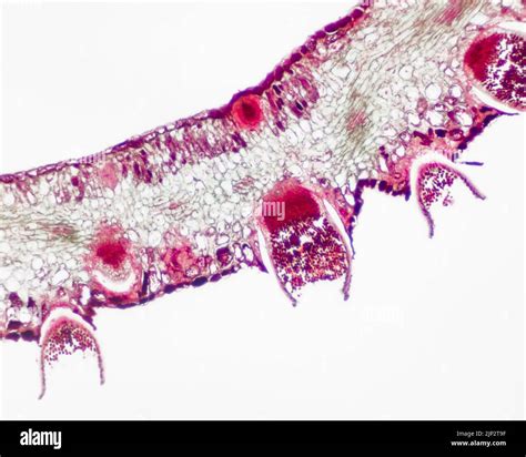 Parasitic plant fungus Puccinia microscope slide Stock Photo - Alamy