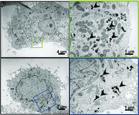 Tem Transmission Electron Microscopy Micrograph Of Huh751 Cells