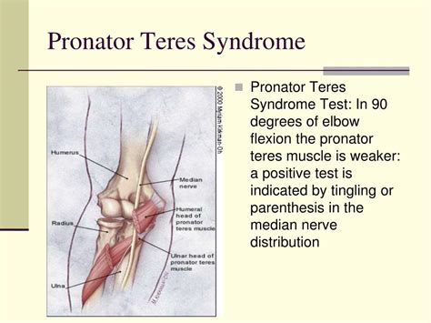 Pronator Teres Syndrome Test