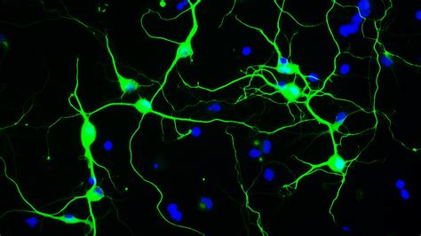 Realizan Un Nuevo Descubrimiento Sobre La Regeneraci N De Neuronas