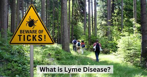 Explained What Is Lyme Disease Know About The Symptoms And Treatment