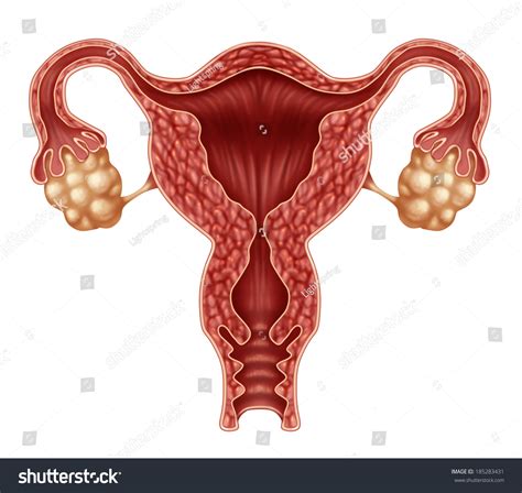 Uterus And Ovaries With Fallopian Tubes As A Human Female Reproduction Concept Isolated On A