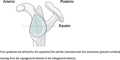 The AO Foundation And Orthopaedic Trauma Association AO OTA Scapula