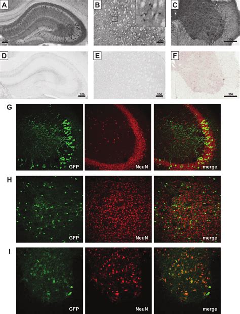 In Vivo Expression Of The Mep Promoter At 14 Weeks In The Cns Adult