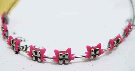 Hello Kitty Braces – Hello Kitty Hell