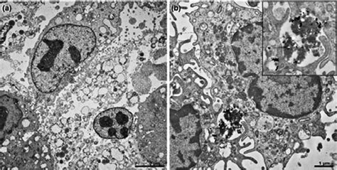 Cells Of Mdck Culture And Primary Macrophages After Three Hour Download Scientific Diagram