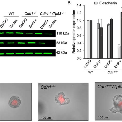 Characterisation Of Mammary Organoids A Endoxifen Endox Mediated