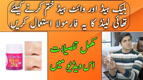 Blackhead Removal On Nose Blackheads Khatam Karne Ka Tarika YouTube