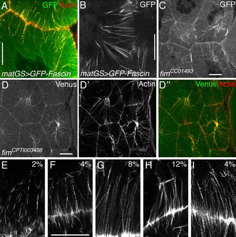 Figure S Related To Figure Localisation Of Actin Bundling Proteins