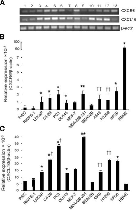 Cxcr Mrna And Cxcl Mrna Are Expressed In Prostate Cancer Cells The