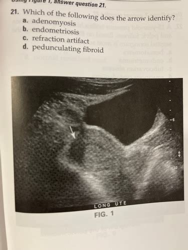 Obstetrics And Gyn Mock Exam Flashcards Quizlet