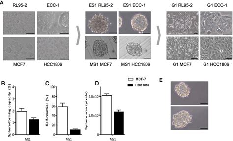 Obtaining Cancer Stem Cell Spheres From Gynecological And Breast Cancer Tumors Protocol