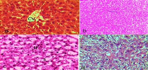 Liver Sections In A Control Showing Healthy Hepatocytes Sinusoids