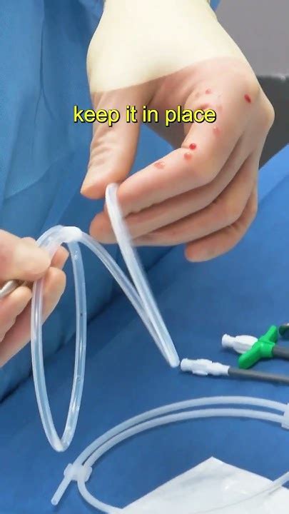 Elements Of A Pleurx Catheter Kit Doctor Hospital Surgeon Howto