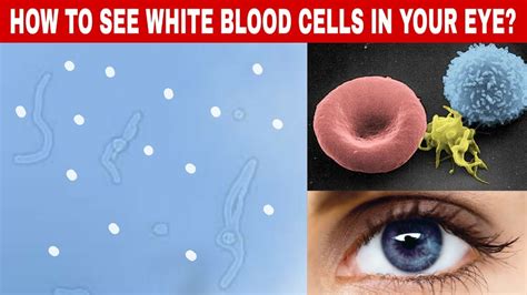 How To See White Blood Cells In Your Eye Blue Field Entoptic